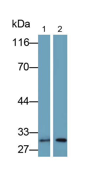 Polyclonal Antibody to Brain Derived Neurotrophic Factor (BDNF)