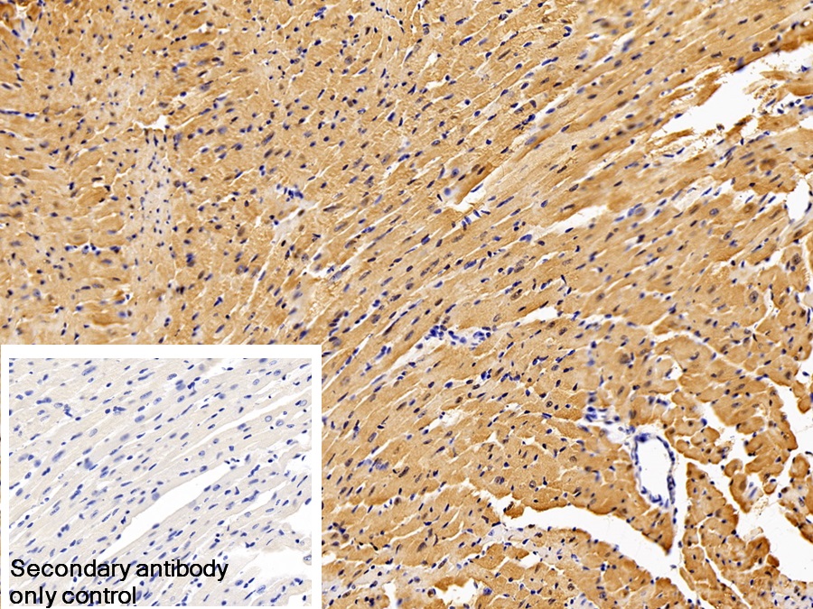 Polyclonal Antibody to S100 Calcium Binding Protein (S100)