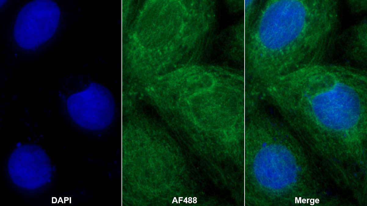 Polyclonal Antibody to Bone Morphogenetic Protein 2 (BMP2)