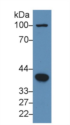 Polyclonal Antibody to Bone Morphogenetic Protein 2 (BMP2)