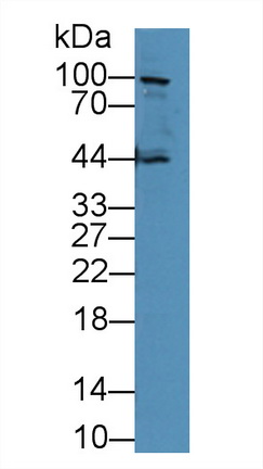 Polyclonal Antibody to E-cadherin