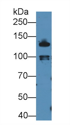 Polyclonal Antibody to E-cadherin