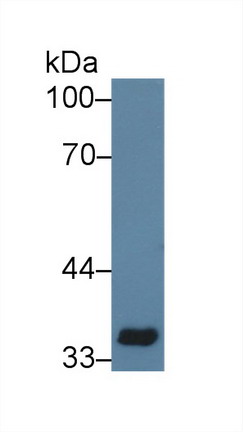 Polyclonal Antibody to Cluster Of Differentiation 33 (CD33)