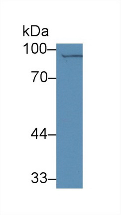 Polyclonal Antibody to Cluster Of Differentiation 33 (CD33)