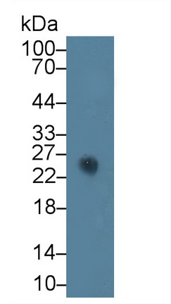 Polyclonal Antibody to Ciliary Neurotrophic Factor (CNTF)