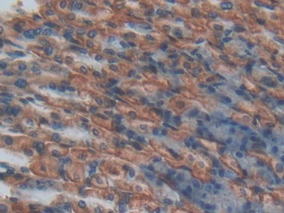 Polyclonal Antibody to Endothelial protein C receptor (EPCR)