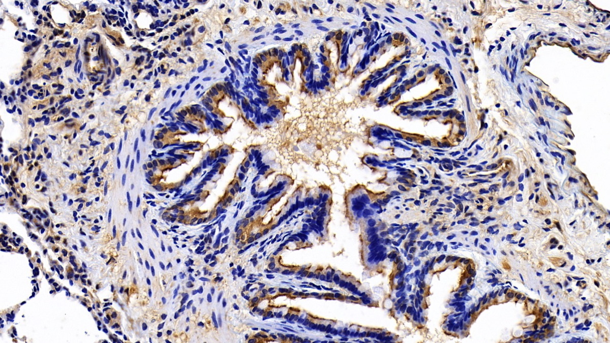 Polyclonal Antibody to Endothelial protein C receptor (EPCR)