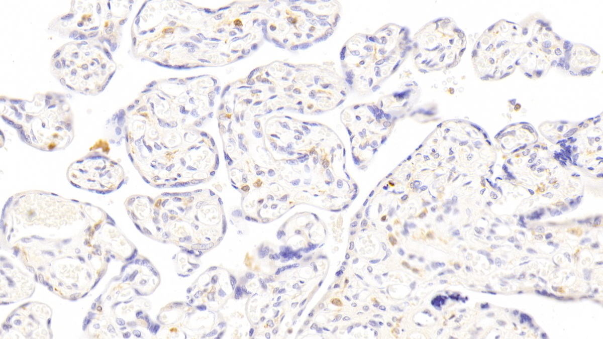 Polyclonal Antibody to Erythropoietin (EPO)