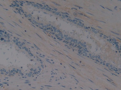 Polyclonal Antibody to Erythropoietin (EPO)