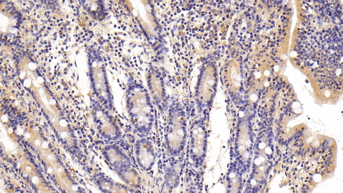 Polyclonal Antibody to Factor Related Apoptosis (FAS)