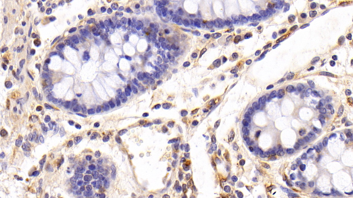 Polyclonal Antibody to Factor Related Apoptosis (FAS)