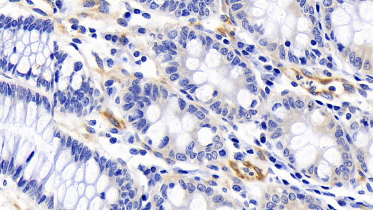 Polyclonal Antibody to Factor Related Apoptosis (FAS)