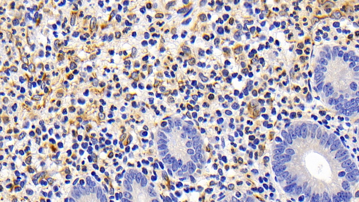 Polyclonal Antibody to Factor Related Apoptosis (FAS)