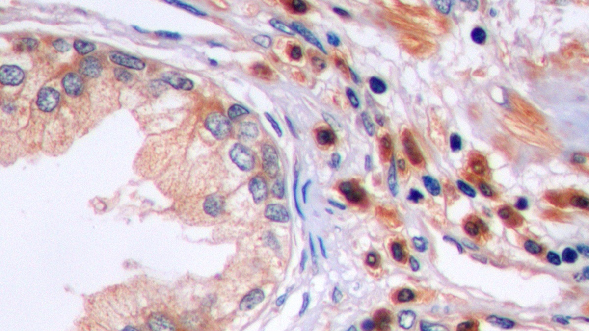 Polyclonal Antibody to Factor Related Apoptosis (FAS)