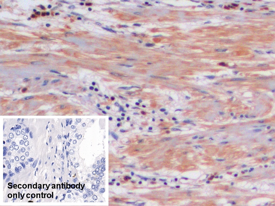 Polyclonal Antibody to Factor Related Apoptosis (FAS)