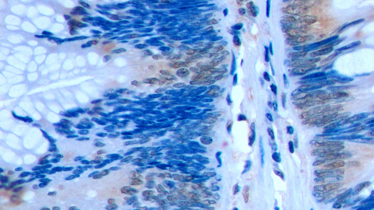 Polyclonal Antibody to Factor Related Apoptosis (FAS)