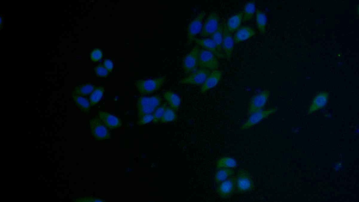 Polyclonal Antibody to Factor Related Apoptosis (FAS)