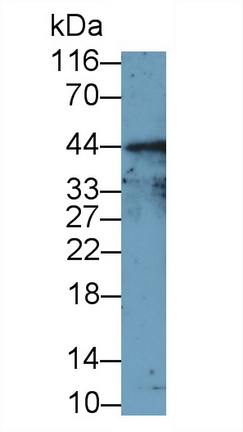 Polyclonal Antibody to Factor Related Apoptosis (FAS)