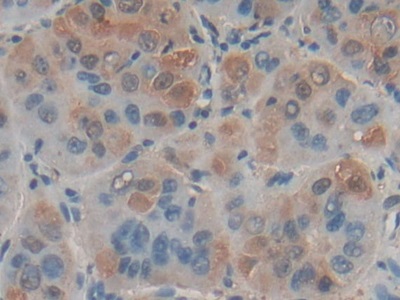 Polyclonal Antibody to Factor Related Apoptosis Ligand (FASL)