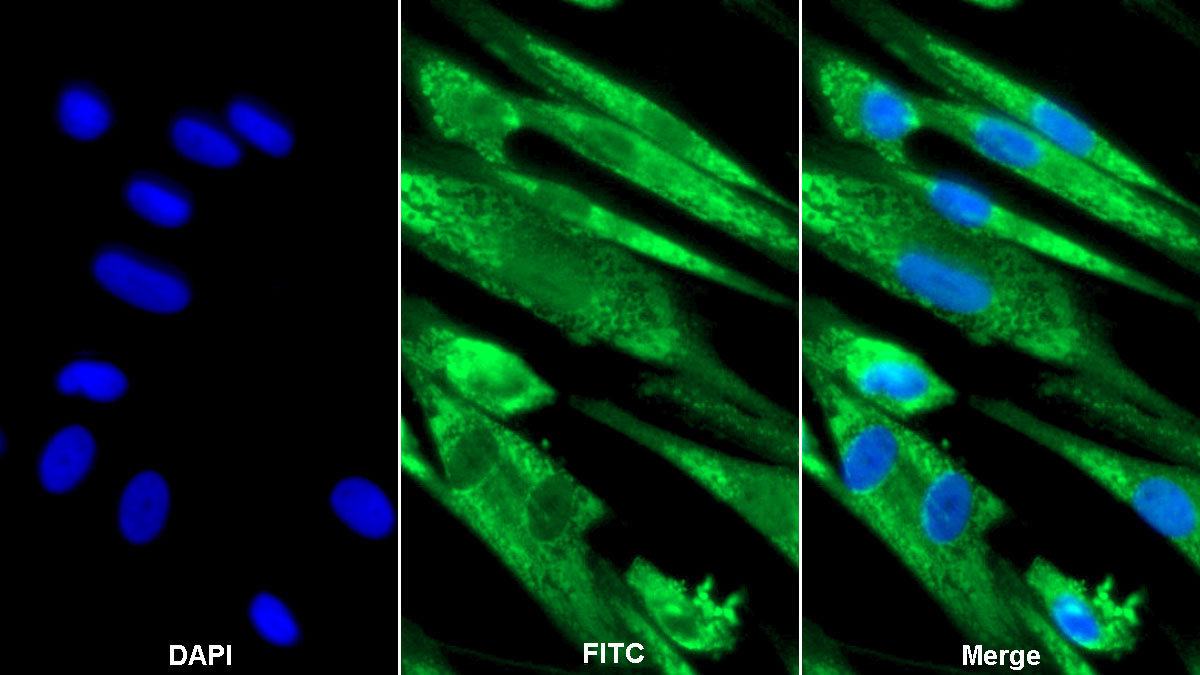 Polyclonal Antibody to Factor Related Apoptosis Ligand (FASL)