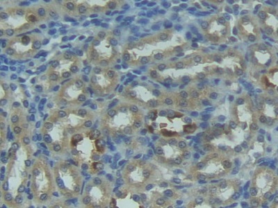 Polyclonal Antibody to Factor Related Apoptosis Ligand (FASL)