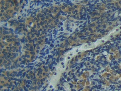 Polyclonal Antibody to Factor Related Apoptosis Ligand (FASL)