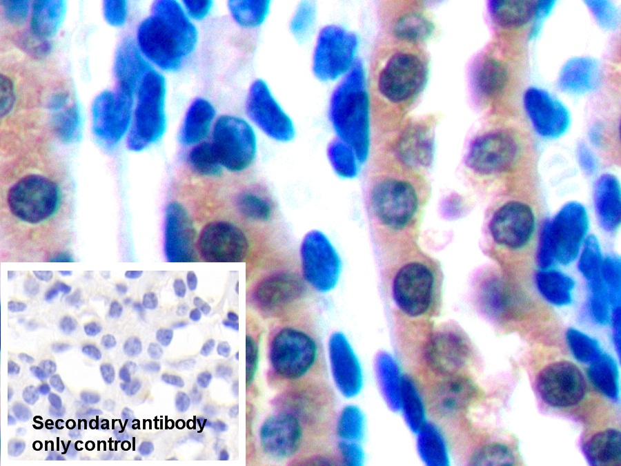 Polyclonal Antibody to Fibroblast Growth Factor 1, Acidic (FGF1)