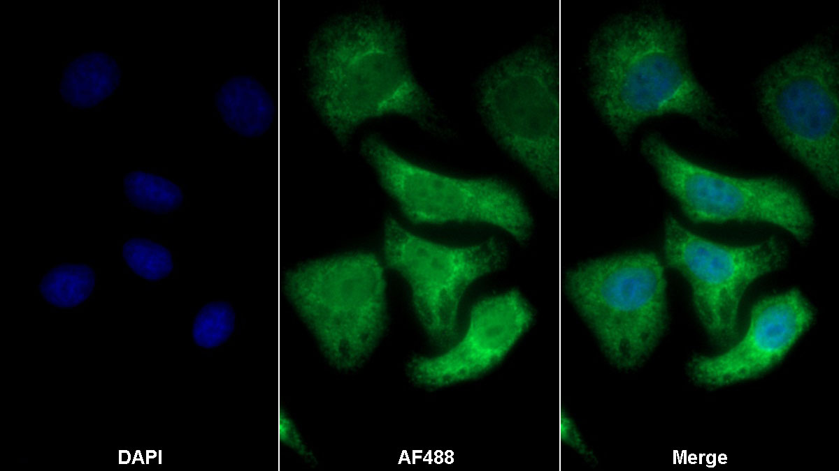 Polyclonal Antibody to Interferon Alpha (IFNa)