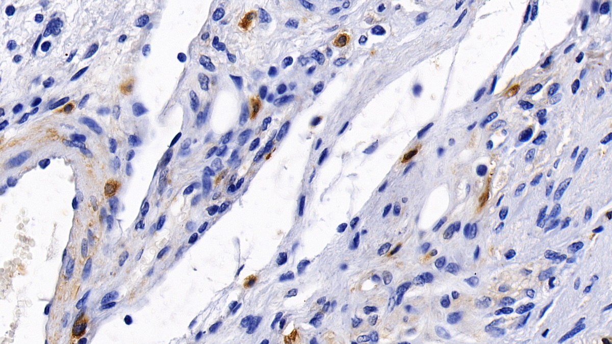 Polyclonal Antibody to Fibroblast Growth Factor 9 (FGF9)