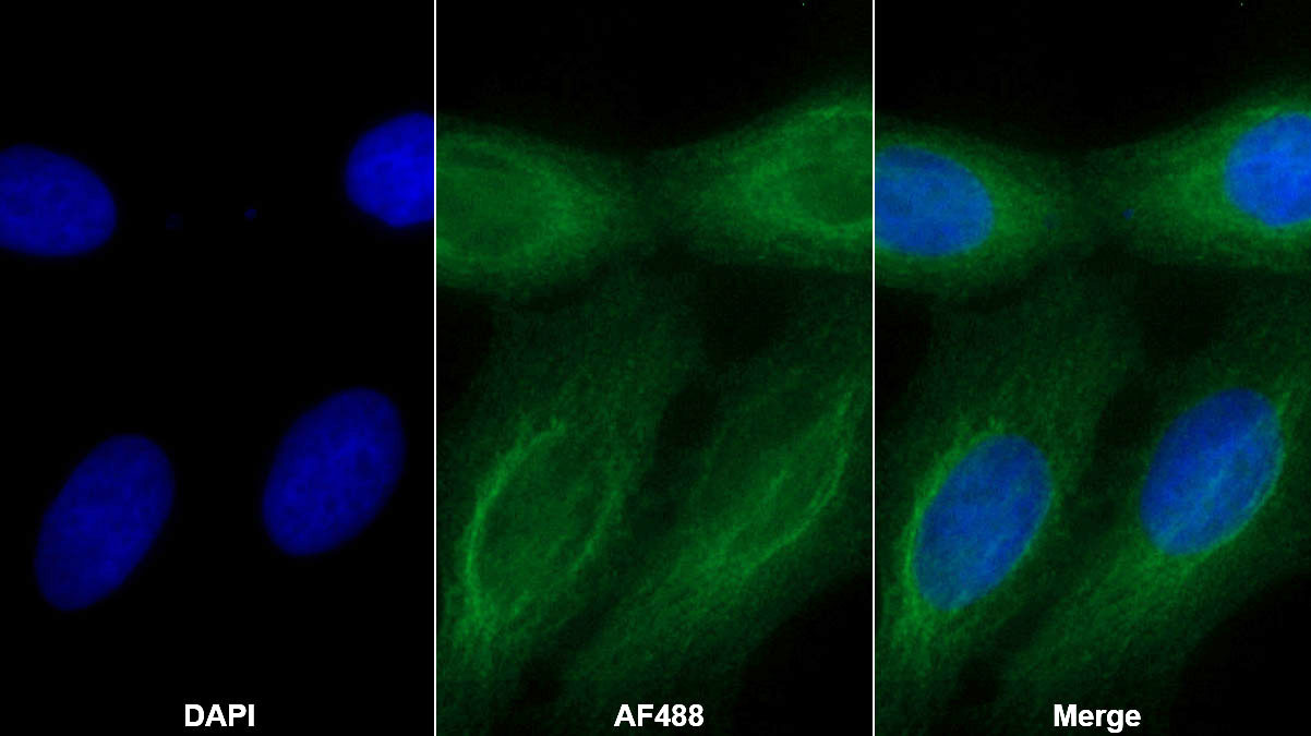 Polyclonal Antibody to Fibroblast Growth Factor 9 (FGF9)