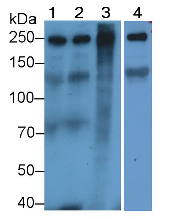 Polyclonal Antibody to Fibronectin (FN)