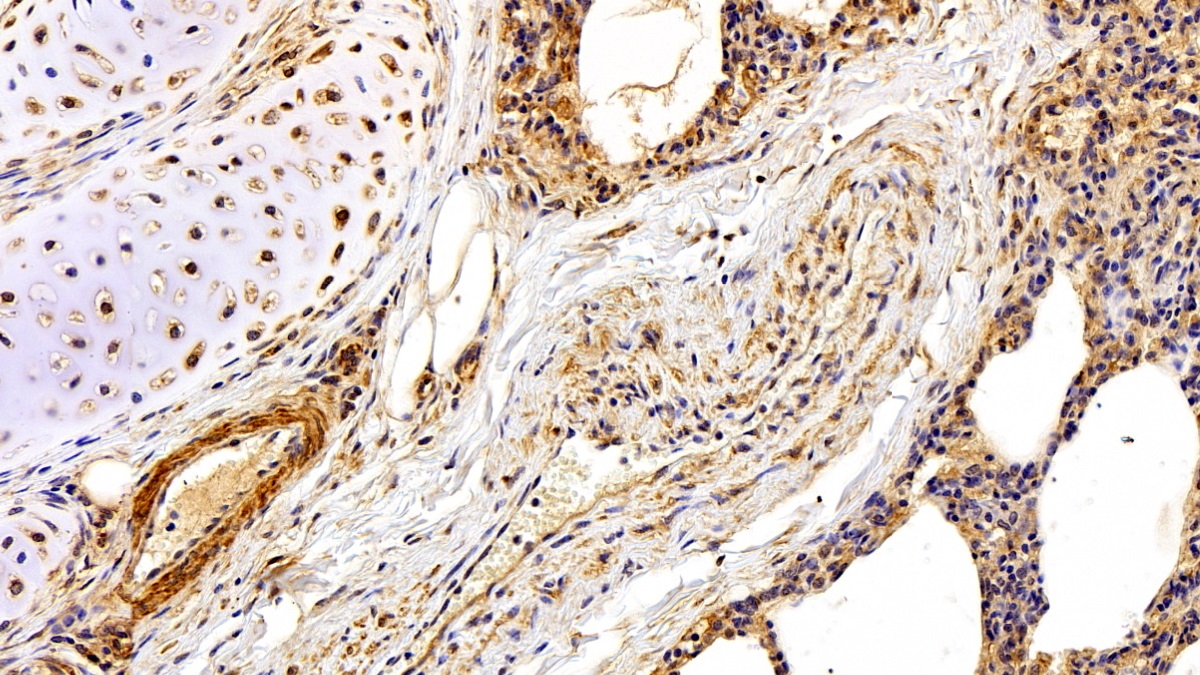 Polyclonal Antibody to Fibronectin (FN)