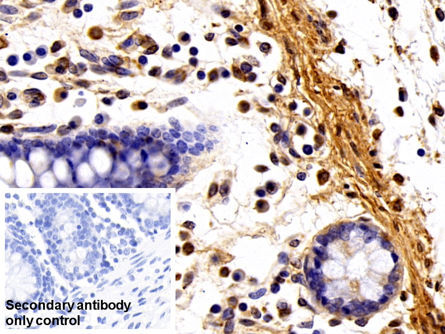 Polyclonal Antibody to Fibronectin (FN)