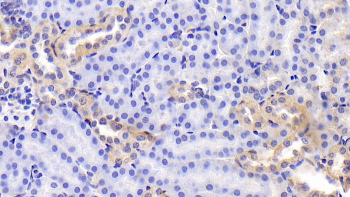 Polyclonal Antibody to Fibronectin (FN)