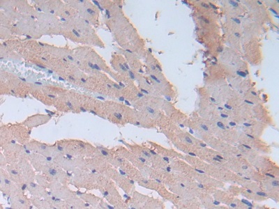 Polyclonal Antibody to Fibronectin (FN)