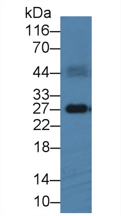 Polyclonal Antibody to FMS Like Tyrosine Kinase 3 Ligand (Flt3L)