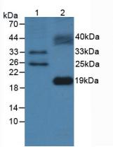 Polyclonal Antibody to FMS Like Tyrosine Kinase 3 Ligand (Flt3L)