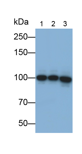 Polyclonal Antibody to FMS Like Tyrosine Kinase 3 (Flt3)