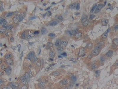 Polyclonal Antibody to Chemokine C-X3-C-Motif Ligand 1 (CX3CL1)