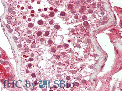 Polyclonal Antibody to Chemokine C-X3-C-Motif Ligand 1 (CX3CL1)