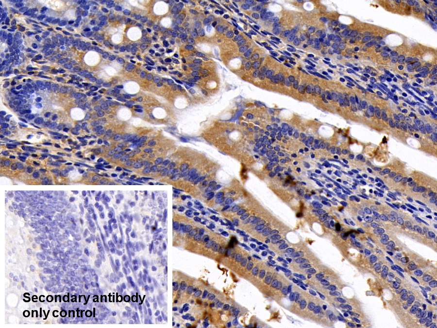 Polyclonal Antibody to Chemokine C-X3-C-Motif Ligand 1 (CX3CL1)