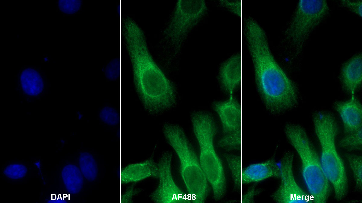 Polyclonal Antibody to Colony Stimulating Factor 3, Granulocyte (GCSF)