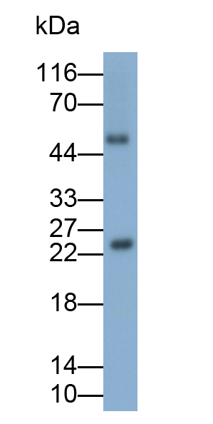 Polyclonal Antibody to Growth Hormone (GH)