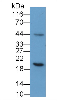 Polyclonal Antibody to Growth Hormone (GH)