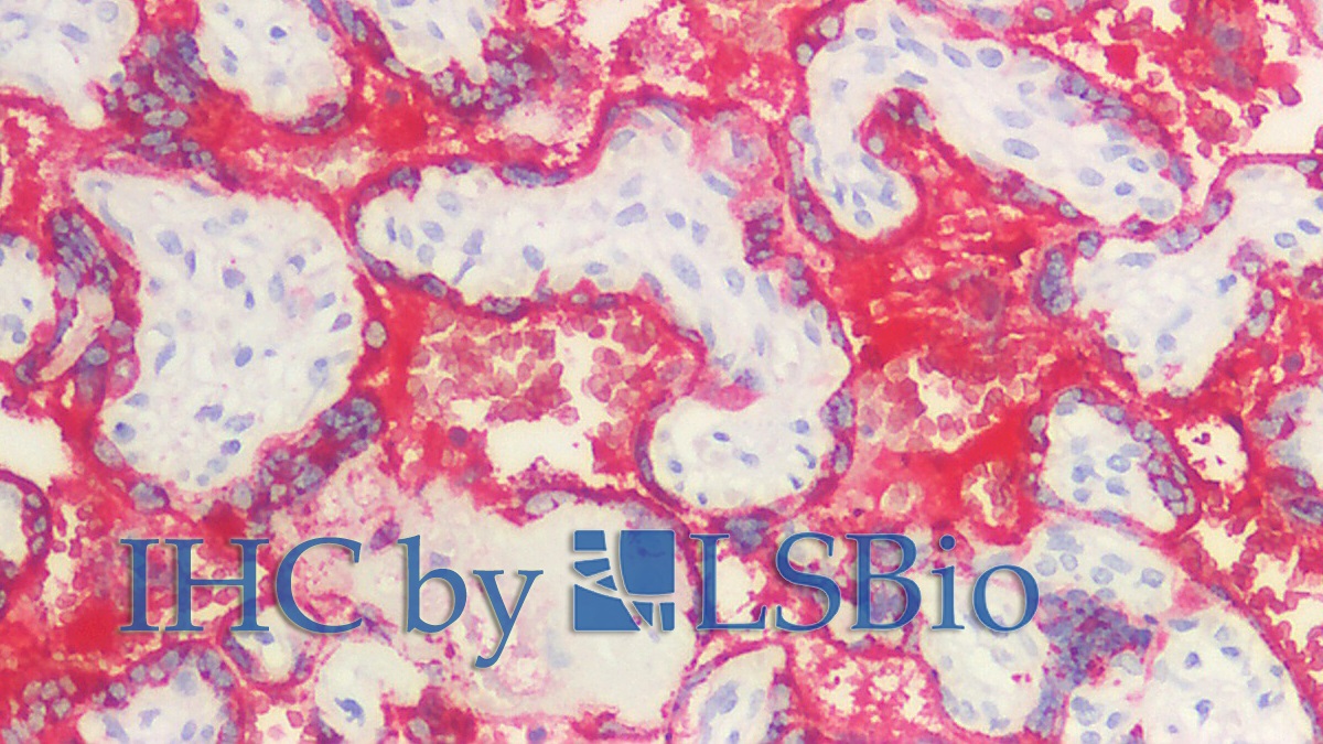 Polyclonal Antibody to Growth Hormone (GH)