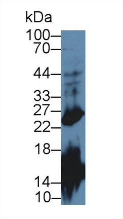 Polyclonal Antibody to Growth Hormone (GH)