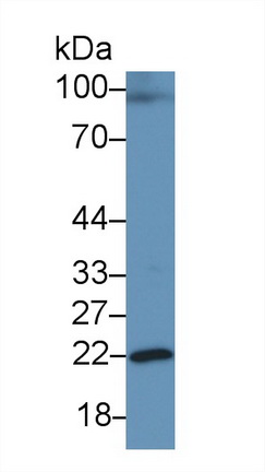 Polyclonal Antibody to Growth Hormone (GH)