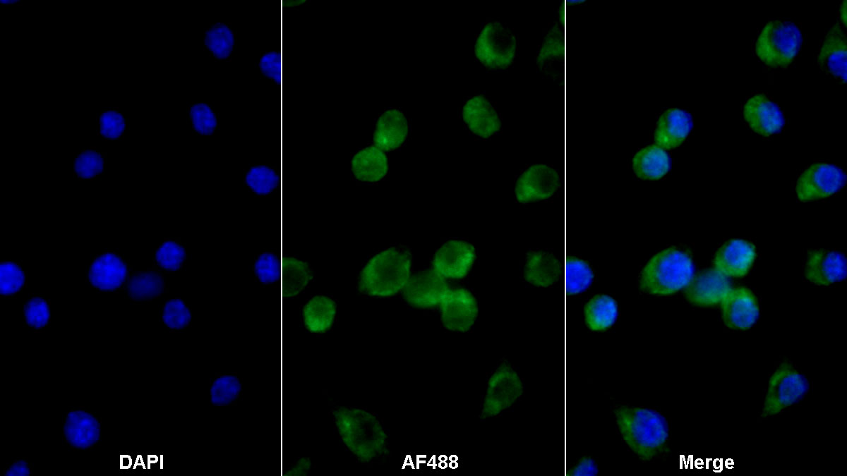 Polyclonal Antibody to Colony Stimulating Factor 2, Granulocyte Macrophage (GM-CSF)