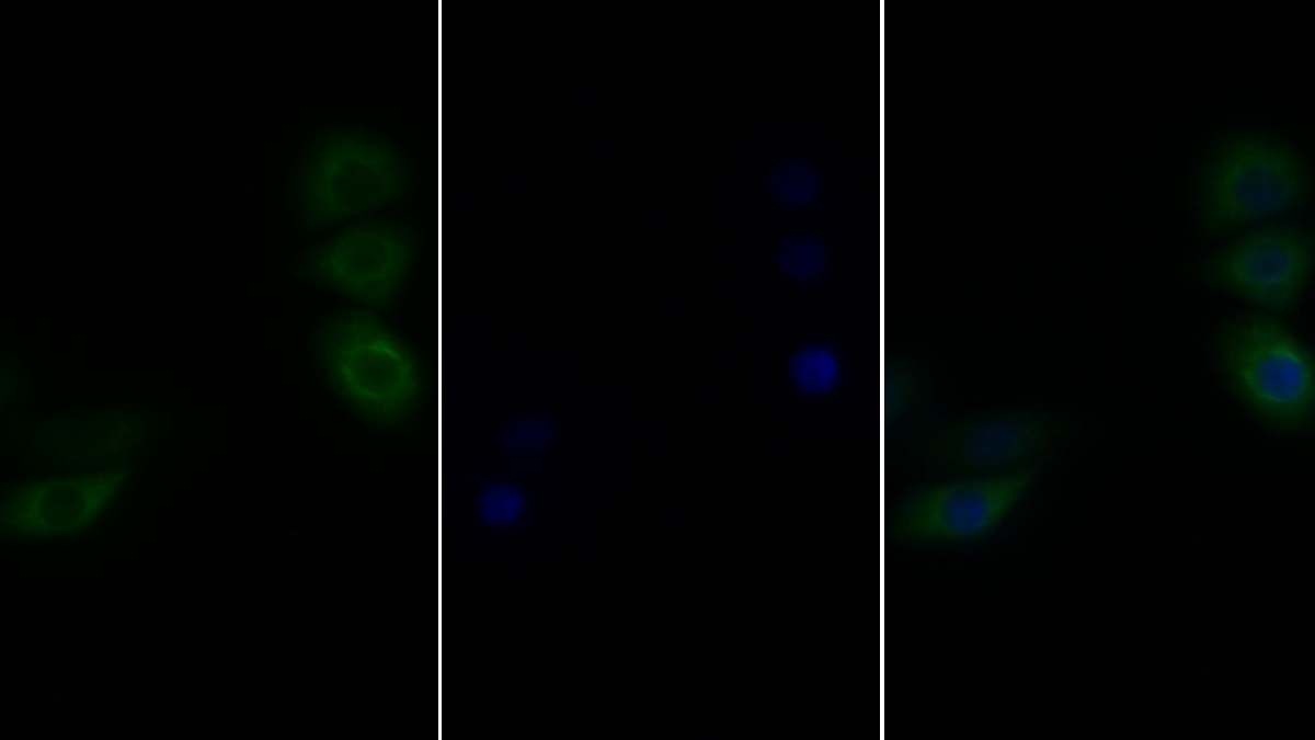 Polyclonal Antibody to Glycoprotein 130 (gp130)