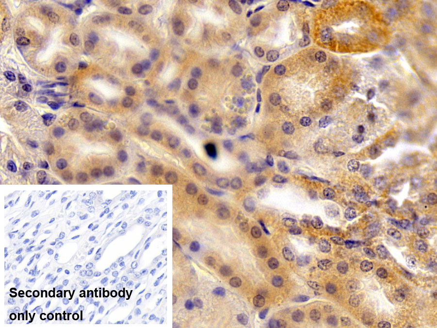 Polyclonal Antibody to Insulin Like Growth Factor 1 (IGF1)